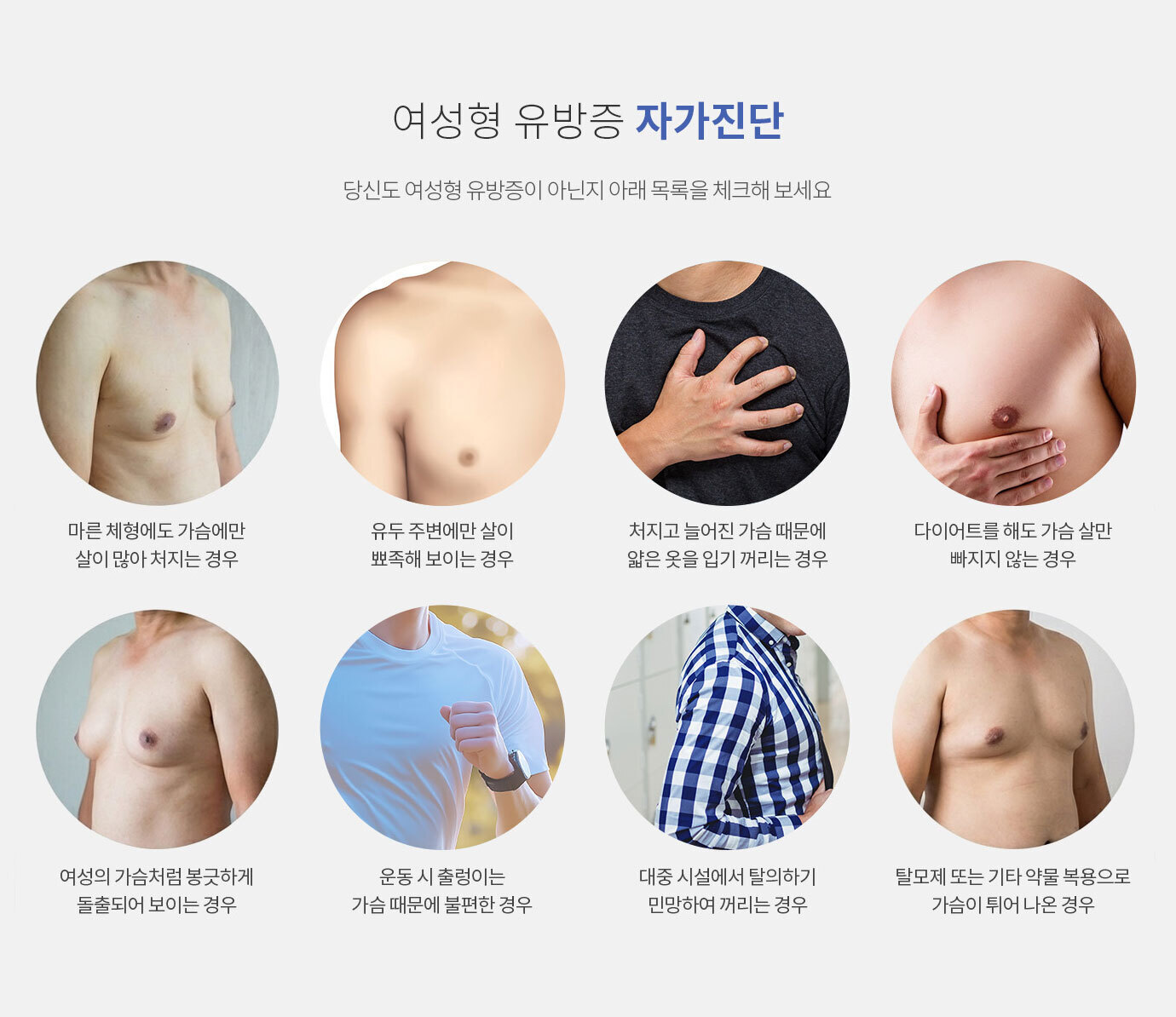 여유증 진단과 수술방법