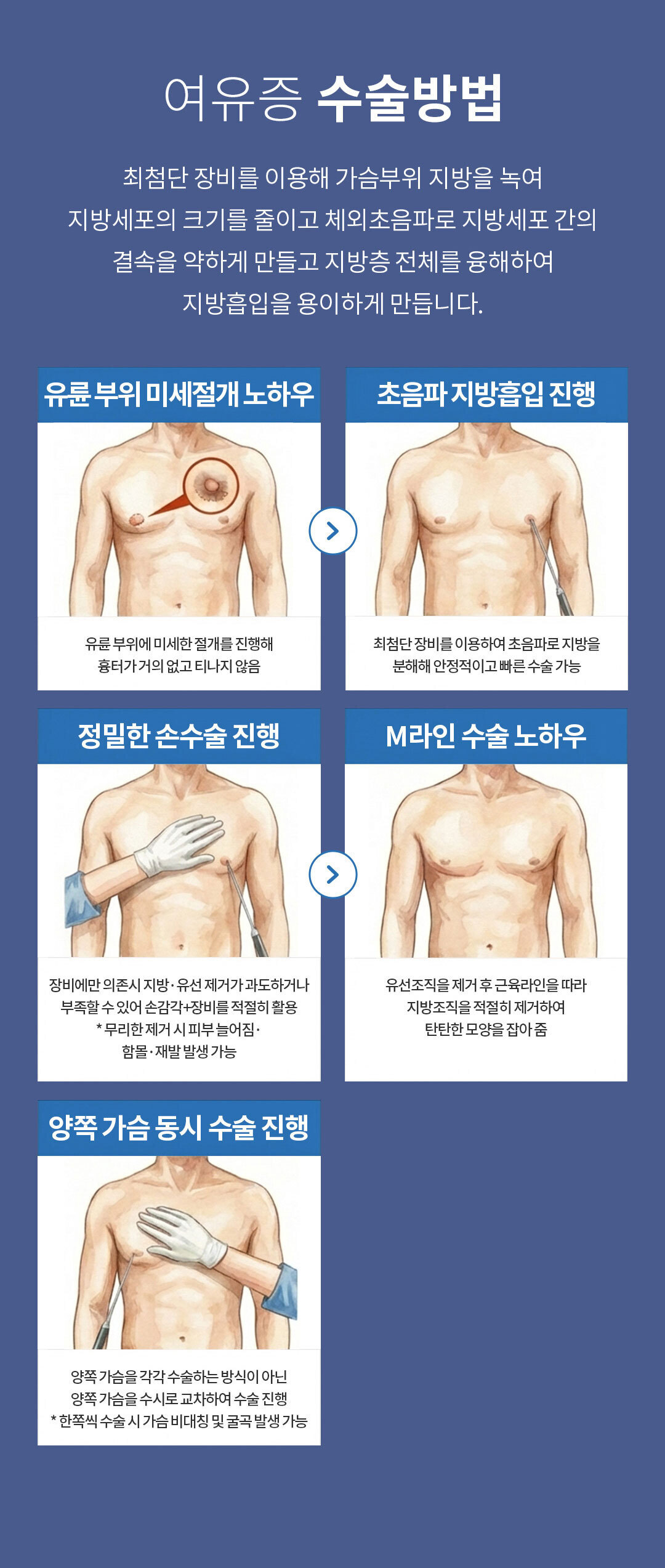 여유증 수술 방법