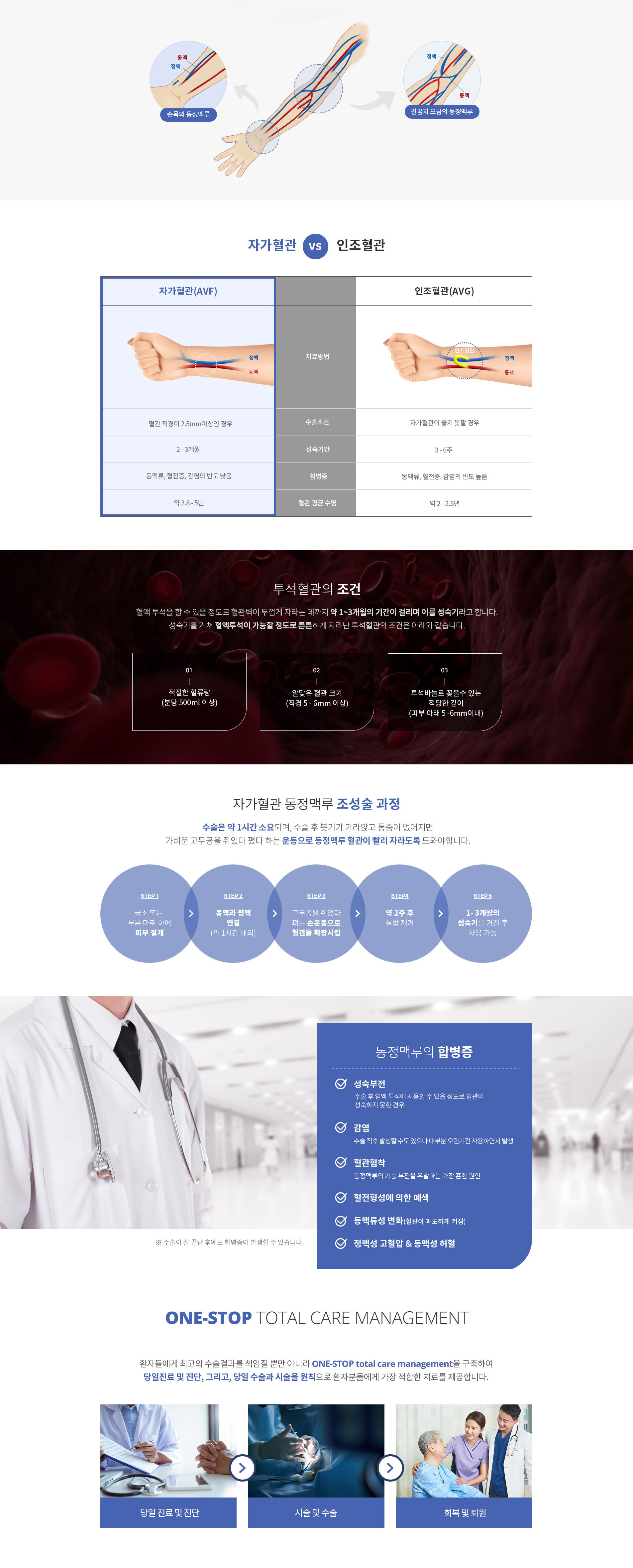 자가혈관 동정맥루 조정술