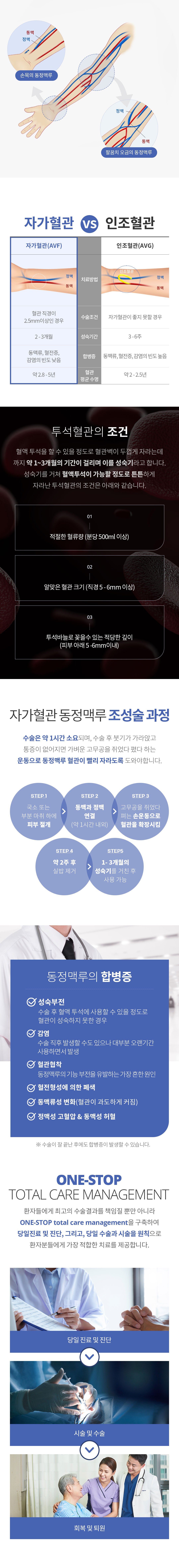 자가혈관 동정맥루 조정술