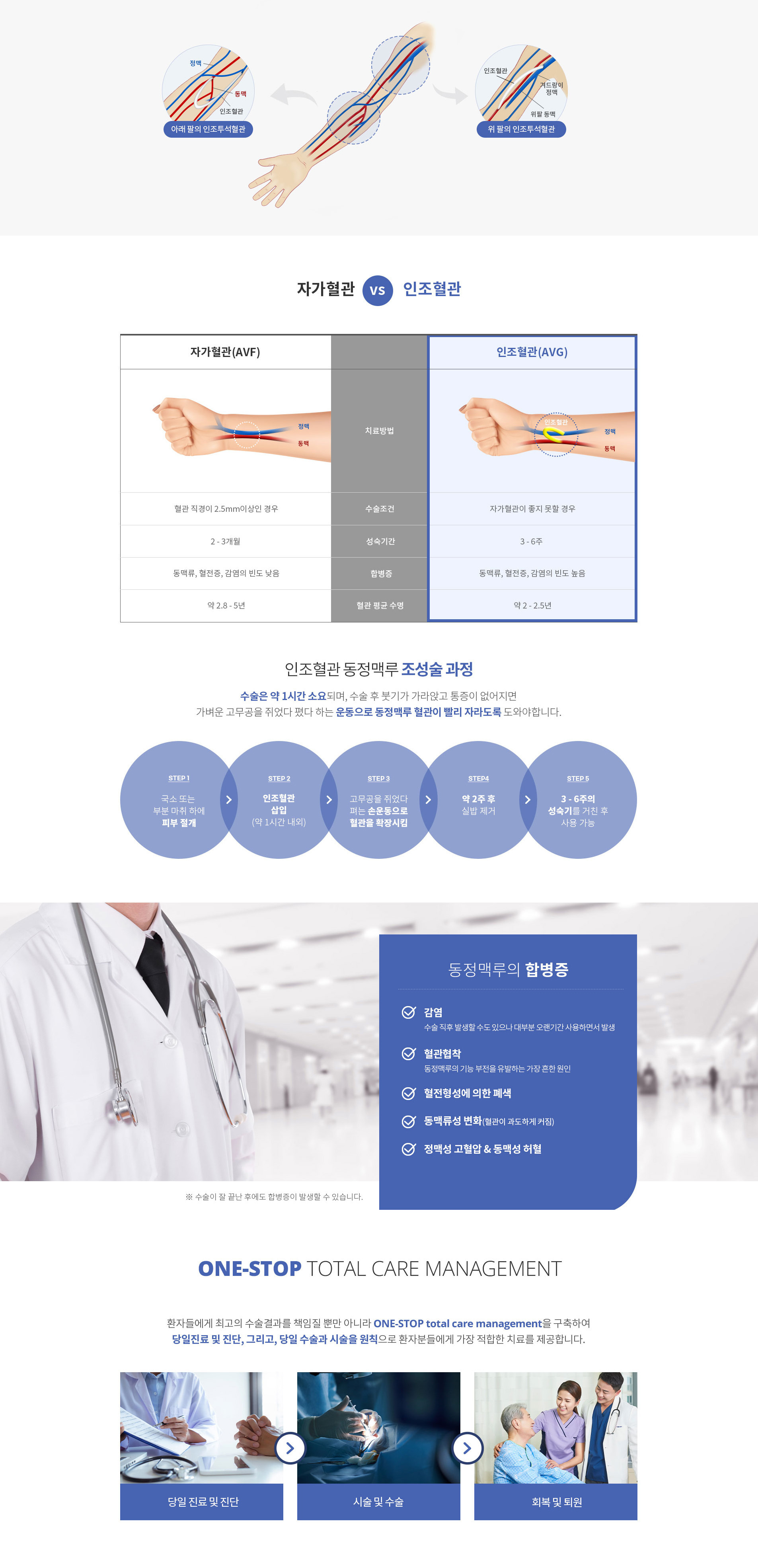 인조혈관 동정맥루 조성술
