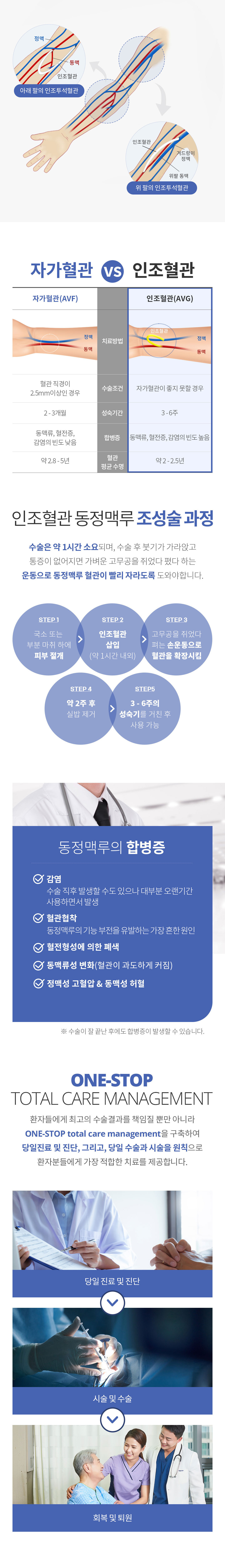 인조혈관 동정맥루 조성술